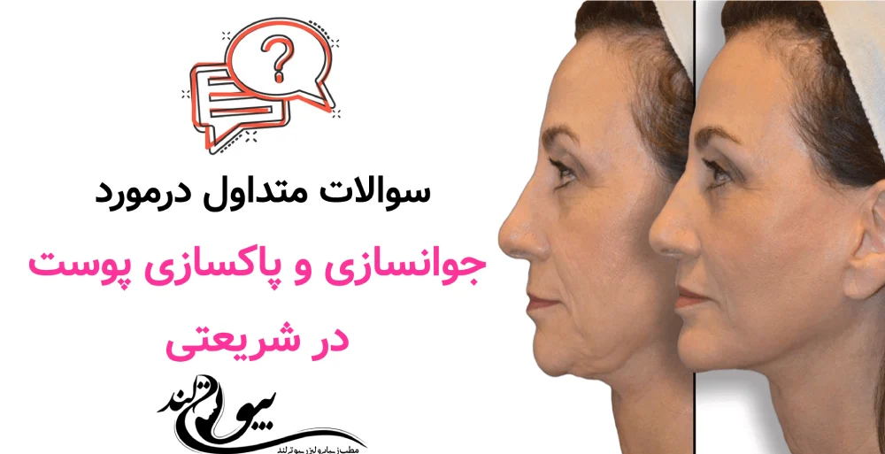 سوالات متداول در جوانسازی و پاکسازی پوست در شریعتی