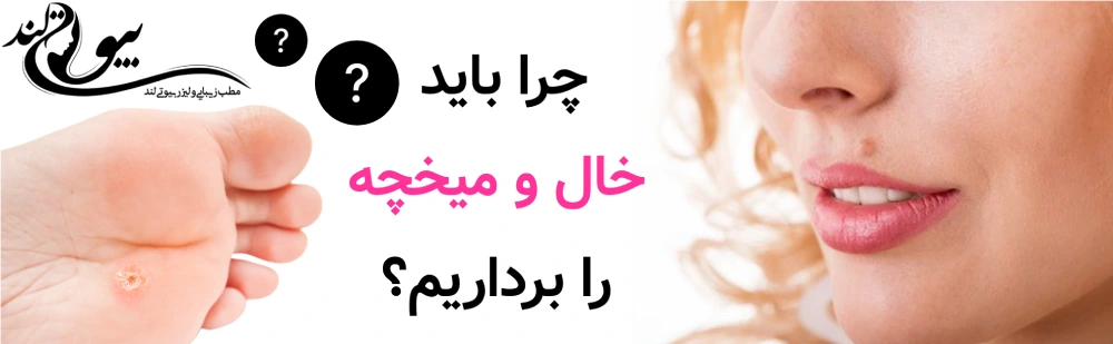 چرا باید خال و میخچه را برداریم؟