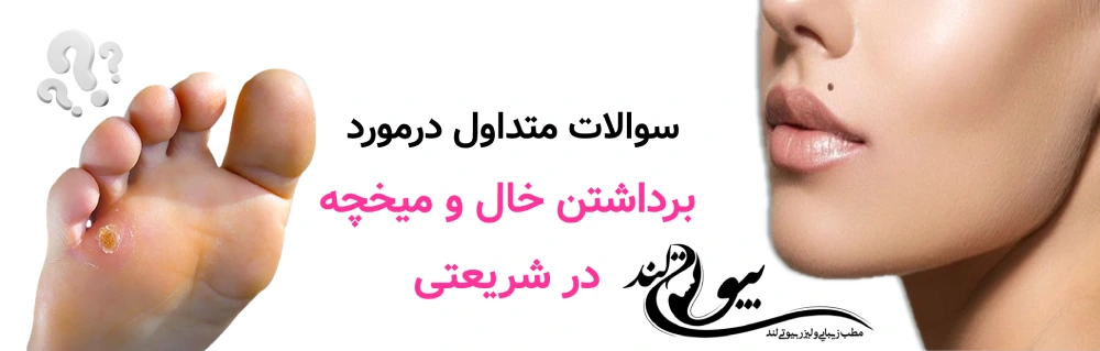 سوالات متداول در برداشتن خال و میخچه در شریعتی