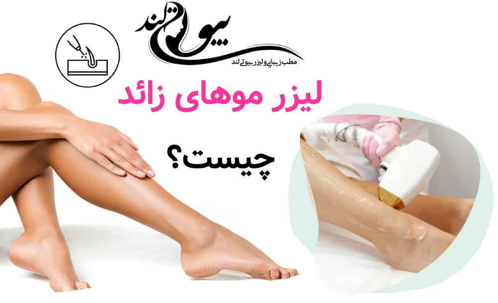 لیزر موهای زائد چیست و چگونه کار می‌کند؟ 