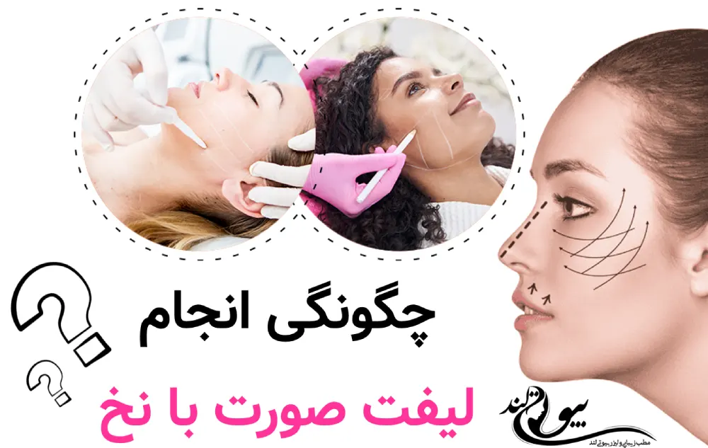 چگونگی انجام لیفت صورت با نخ: مراحل و فرآیند 