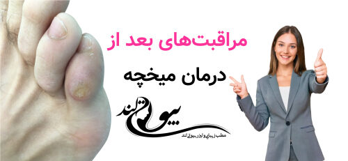 مراقبت‌های بعد از درمان میخچه