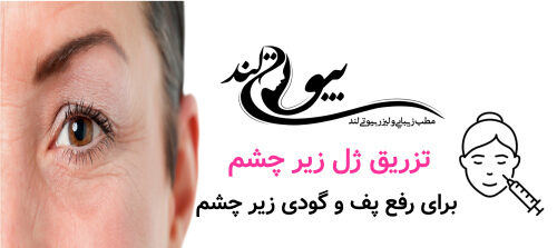 تزریق ژل زیر چشم برای رفع پف و گودی چشم