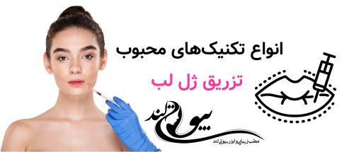 انواع تکنیک‌های محبوب تزریق ژل لب