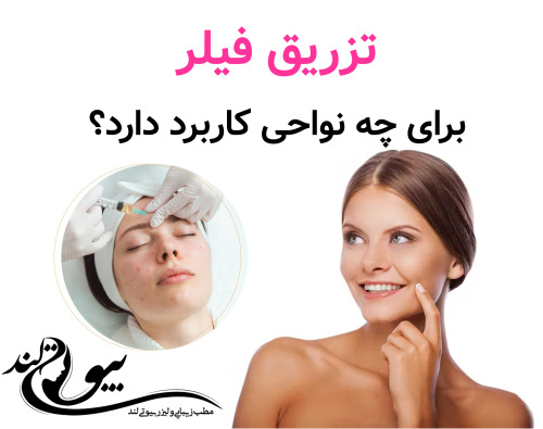 تزریق فیلر برای چه نواحی کاربرد دارد؟
