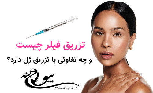فیلر چیست و چه تفاوتی با تزریق ژل دارد