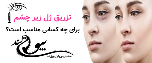 تزریق ژل زیر چشم برای چه کسانی مناسب است؟