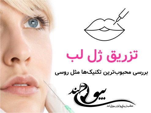 تزریق ژل لب، بررسی محبوب‌ترین تکنیک‌ها مثل روسی