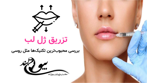 تزریق ژل لب؛ بررسی محبوب‌ترین تکنیک‌ها مثل روسی