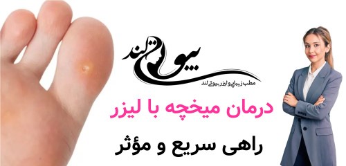 درمان میخچه با لیزر؛ راهی سریع و مؤثر