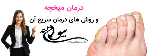 درمان میخچه و روش درمان سریع آن