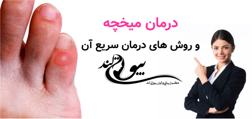 درمان میخچه و روش های درمان سریع آن