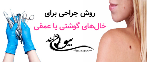 روش جراحی برای خال‌های گوشتی یا عمقی