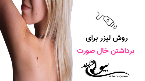 روش لیزر برای برداشتن خال صورت