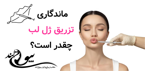 ماندگاری تزریق ژل لب چقدر است؟