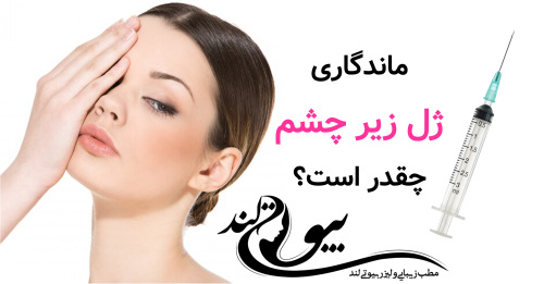 ماندگاری ژل زیر چشم چقدر است؟