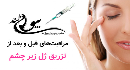 مراقبت‌های قبل و بعد از تزریق ژل زیر چشم