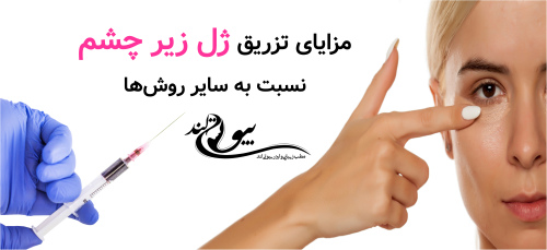 مزایای تزریق ژل زیر چشم نسبت به سایر روش‌ها