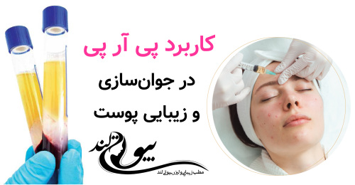 کاربرد پی آر پی در جوان‌سازی و زیبایی پوست