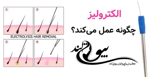 الکترولیز چگونه عمل می‌کند؟