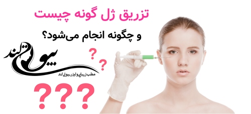 تزریق ژل گونه چیست و چگونه انجام می‌شود؟