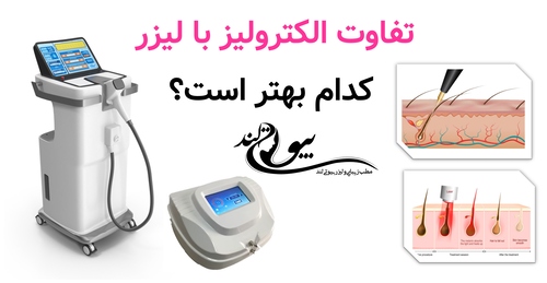 تفاوت الکترولیز با لیزر؛ کدام بهتر است؟