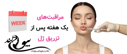 مراقبت‌های یک هفته پس از تزریق ژل