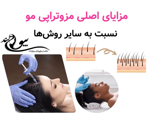 مزایای اصلی مزوتراپی مو نسبت به سایر روش‌ها