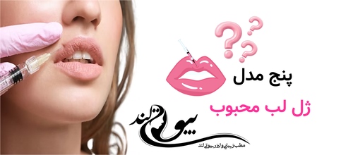 پنج مدل ژل لب محبوب؟