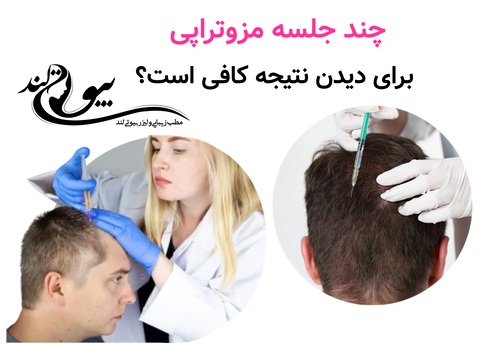 چند جلسه مزوتراپی برای دیدن نتیجه کافی است؟