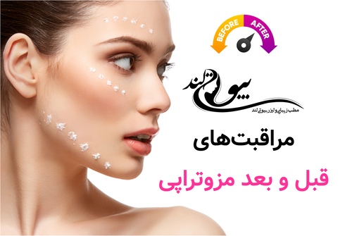 مراقبت های قبل و بعد مزوتراپی