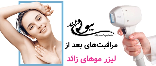 مراقبت‌های بعد از لیزر موهای زائد