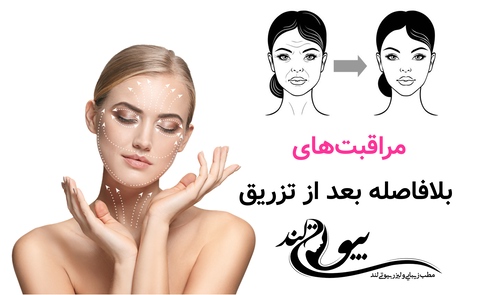 مراقبت‌های بلافاصله بعد از تزریق