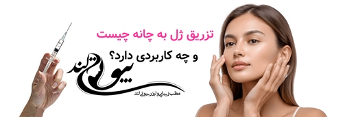 تزریق ژل به چانه چیست و چه کاربردی دارد؟