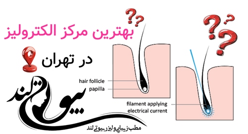 بهترین مرکز الکترولیز در تهران
