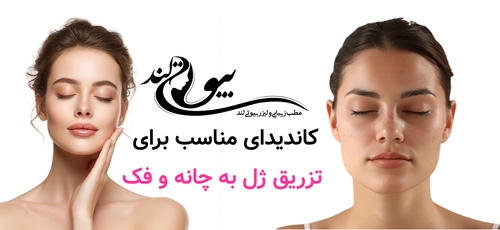کاندیدای مناسب برای تزریق ژل به چانه و فک