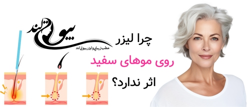 چرا لیزر روی موهای سفید اثر ندارد؟