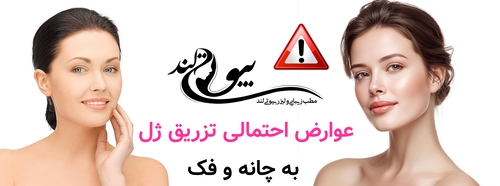 عوارض احتمالی تزریق ژل به چانه و فک