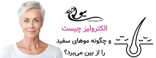 الکترولیز چیست و چگونه موهای سفید را از بین میبرد؟
