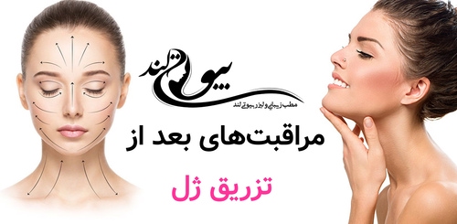 مراقبت‌های بعد از تزریق ژل