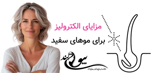 مزایای الکترولیز برای موهای سفید