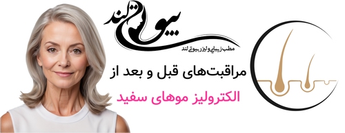 مراقبتهای قبل و بعد از الکترولیز موهای سفید