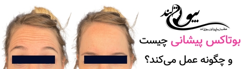 بوتاکس پیشانی چیست و چگونه عمل می‌کند؟