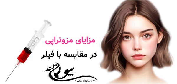 مزایای مزوتراپی در مقایسه با فیلر