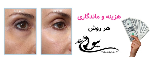 هزینه و ماندگاری هر روش