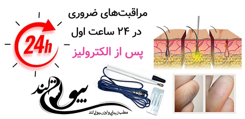مراقبت‌های ضروری در ۲۴ ساعت اول پس از الکترولیز