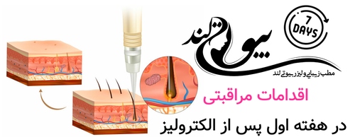 اقدامات مراقبتی در هفته اول پس از الکترولیز