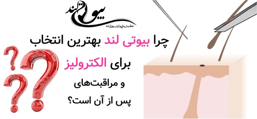 چرا بیوتی لند بهترین انتخاب برای الکترولیز و مراقبت‌های پس از آن است؟