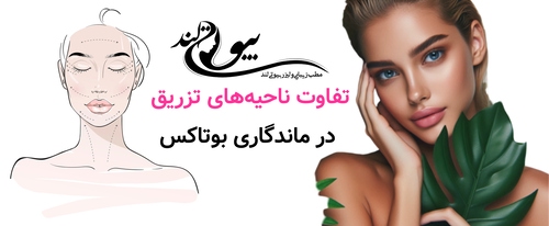 تفاوت ناحیههای تزریق در ماندگاری بوتاکس