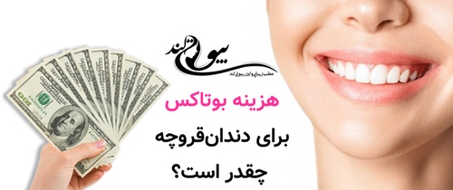 هزینه بوتاکس برای دندانقروچه چقدر است؟